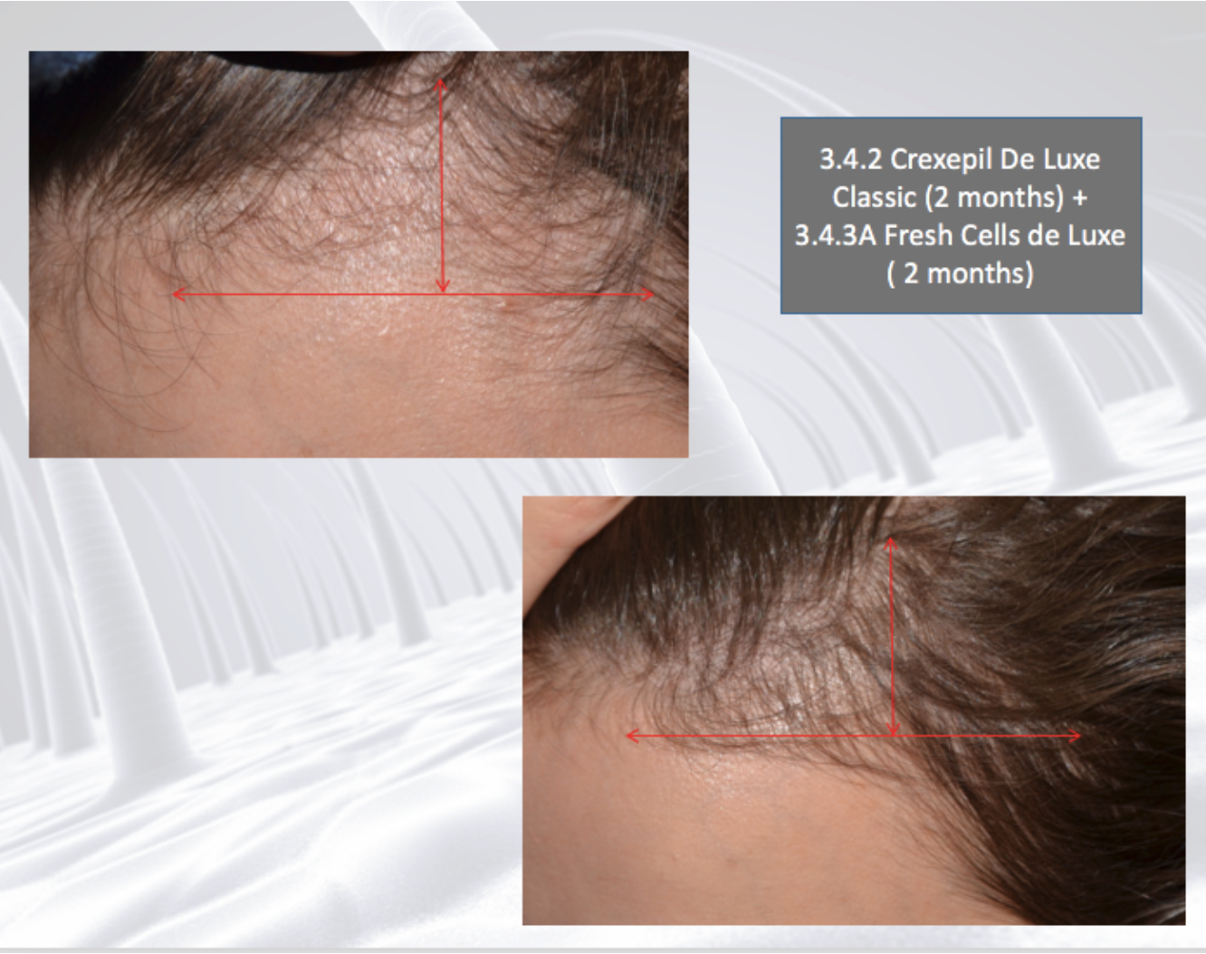 DSD De Luxe 3.4.3A Wondercell Lotion